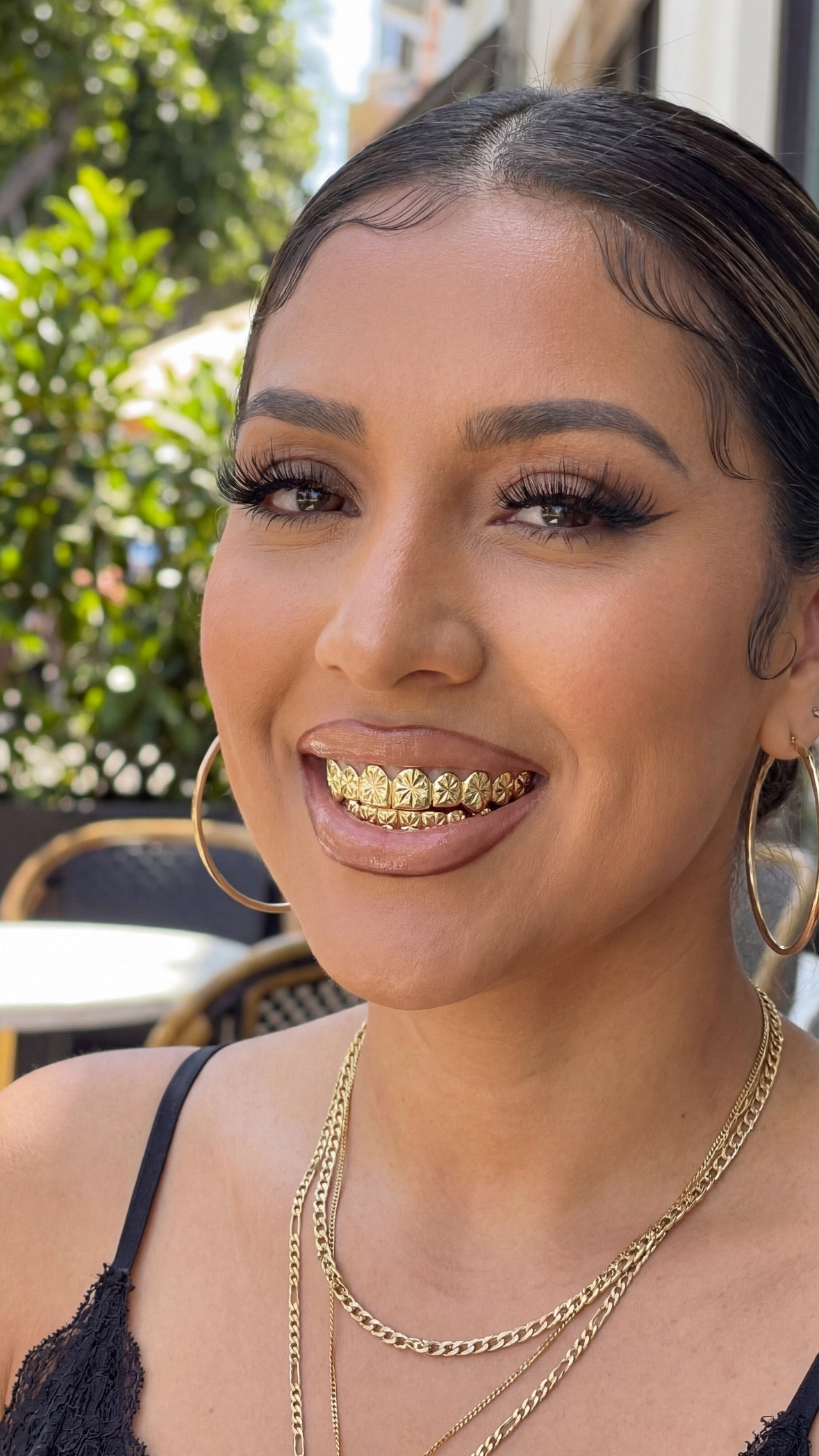 Solid Gold Starburst Grillz