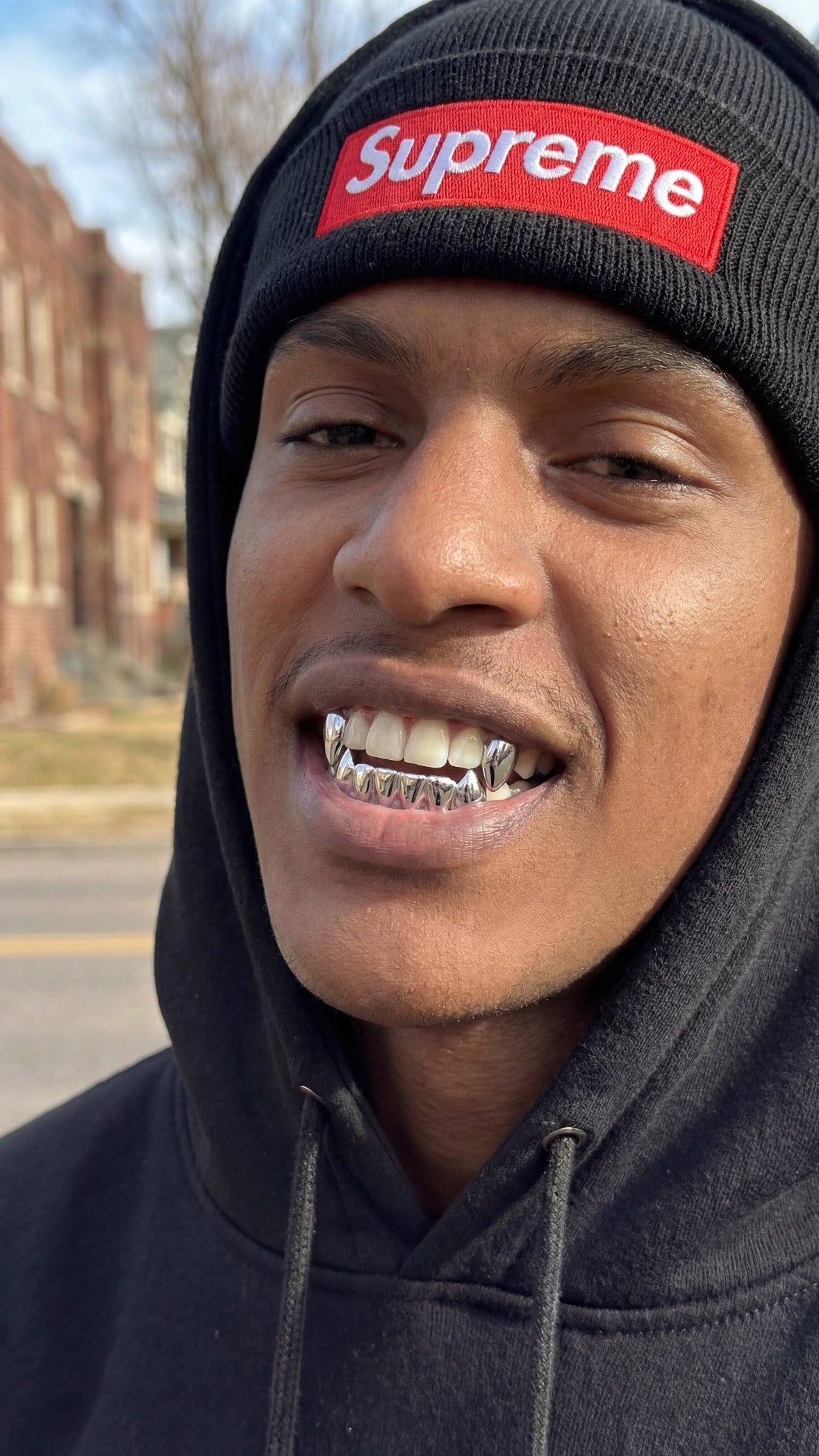 Solid 925 Silver Custom Grillz
